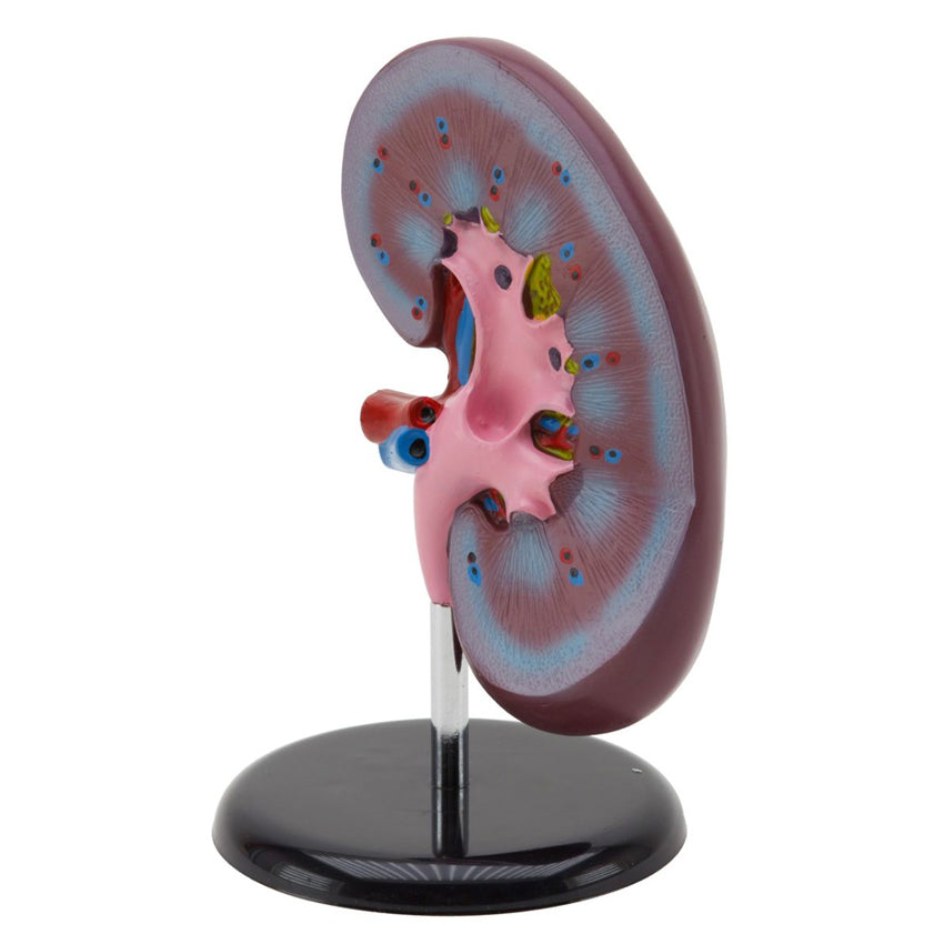 Maqueta de Riñon